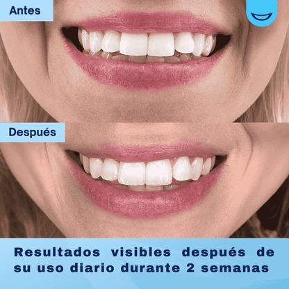 MySweetSmile™ – Polvo Blanqueador Dental Avanzado